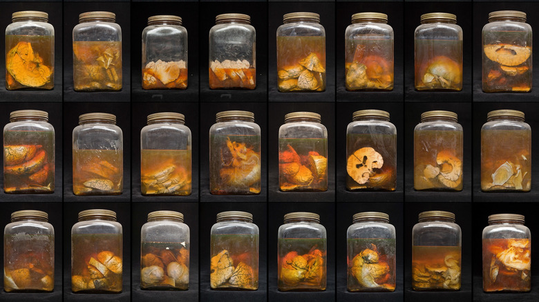 Brains in jars at the Cushing Center at Yale University