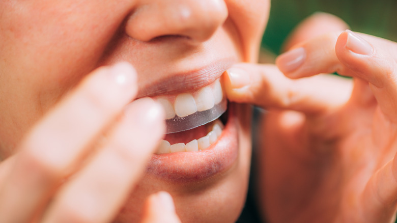 A woman applying dental strips