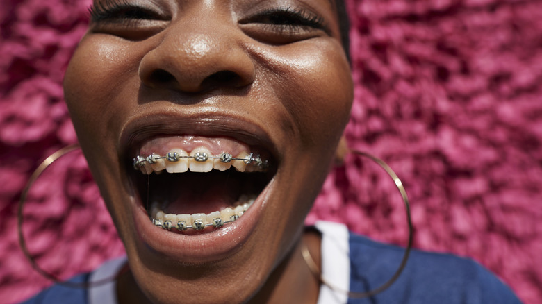 Woman with braces